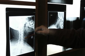 xray 2